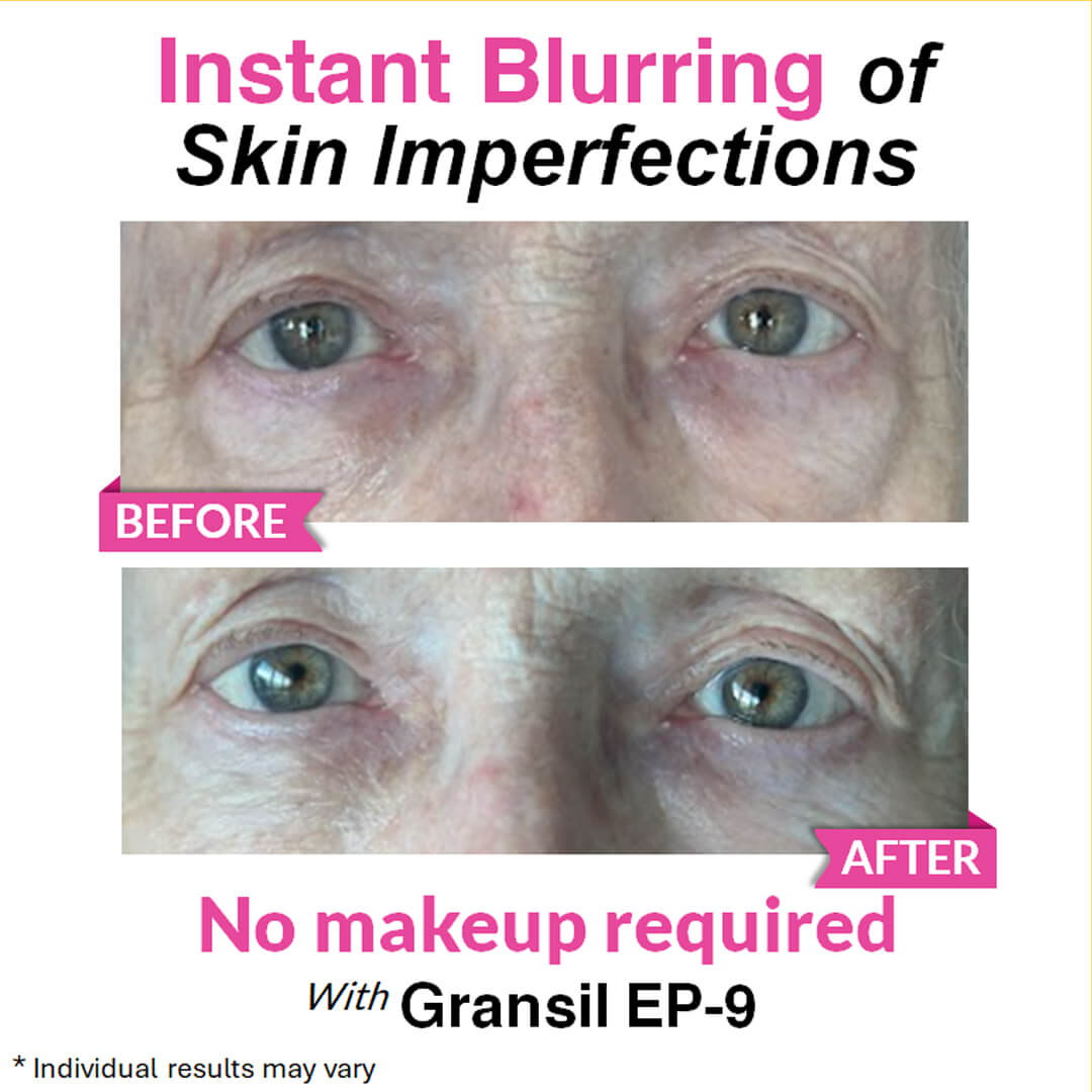 Eye Renewal Serum