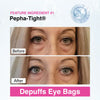 Eye Renewal Serum