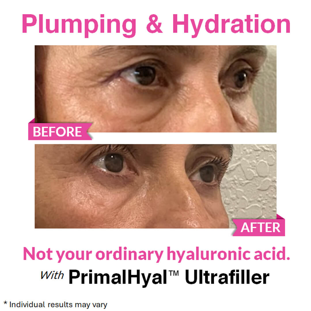 Eye Renewal Serum