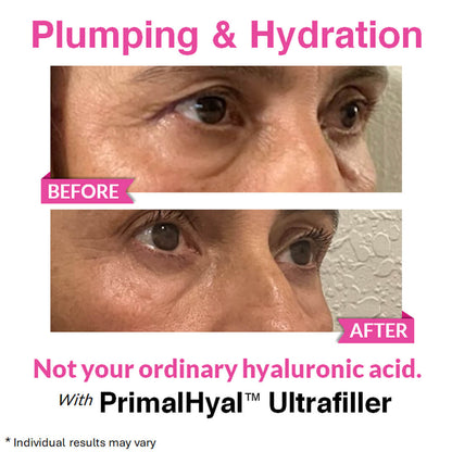 Eye Renewal Serum