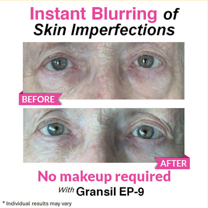 Eye Renewal Serum