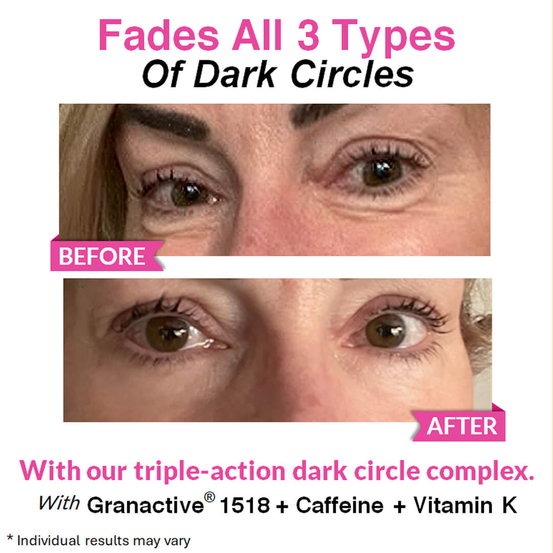 Eye Renewal Serum