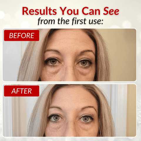 Bright Eyes Holiday Duo