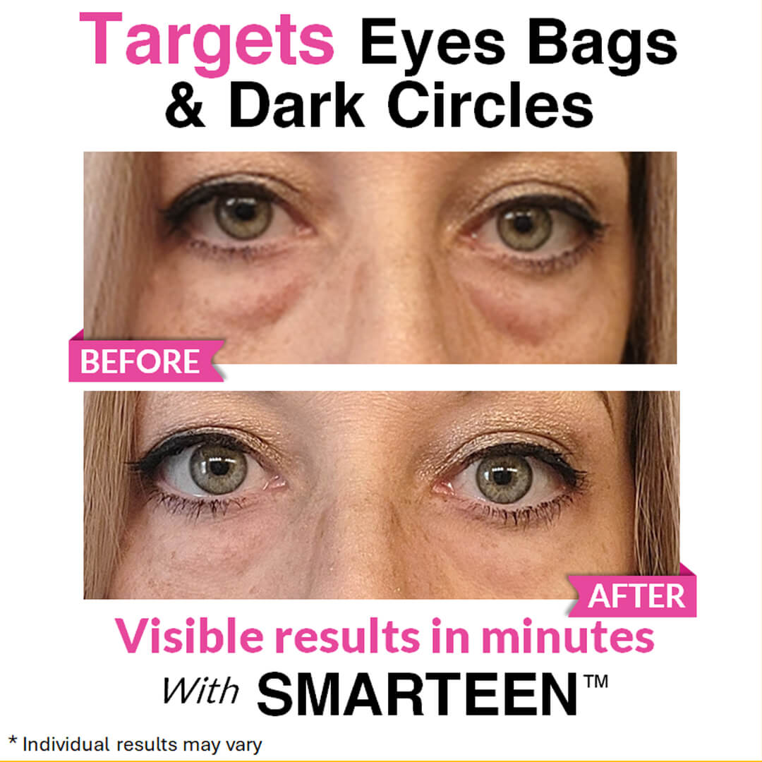 Eye Renewal Serum