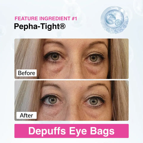 Eye Renewal Serum