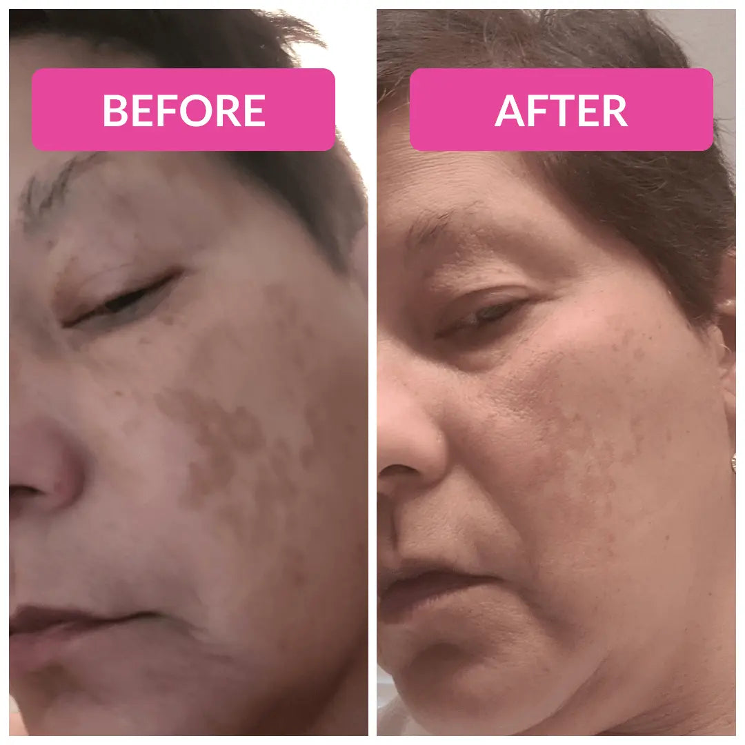 Super C Serum