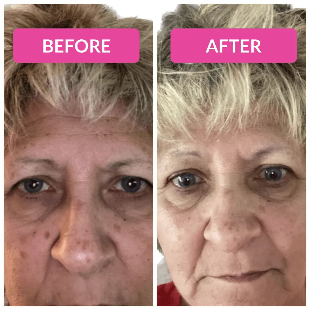 Super C Serum